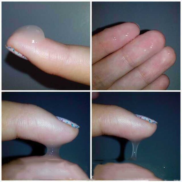 What does it look like